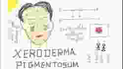 Xeroderma Pigmentosum