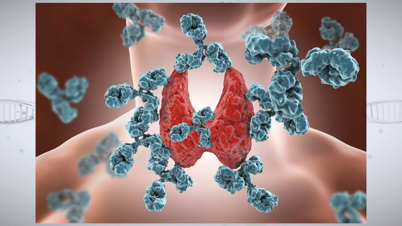 Understanding Autoimmune Thyroid Disease
